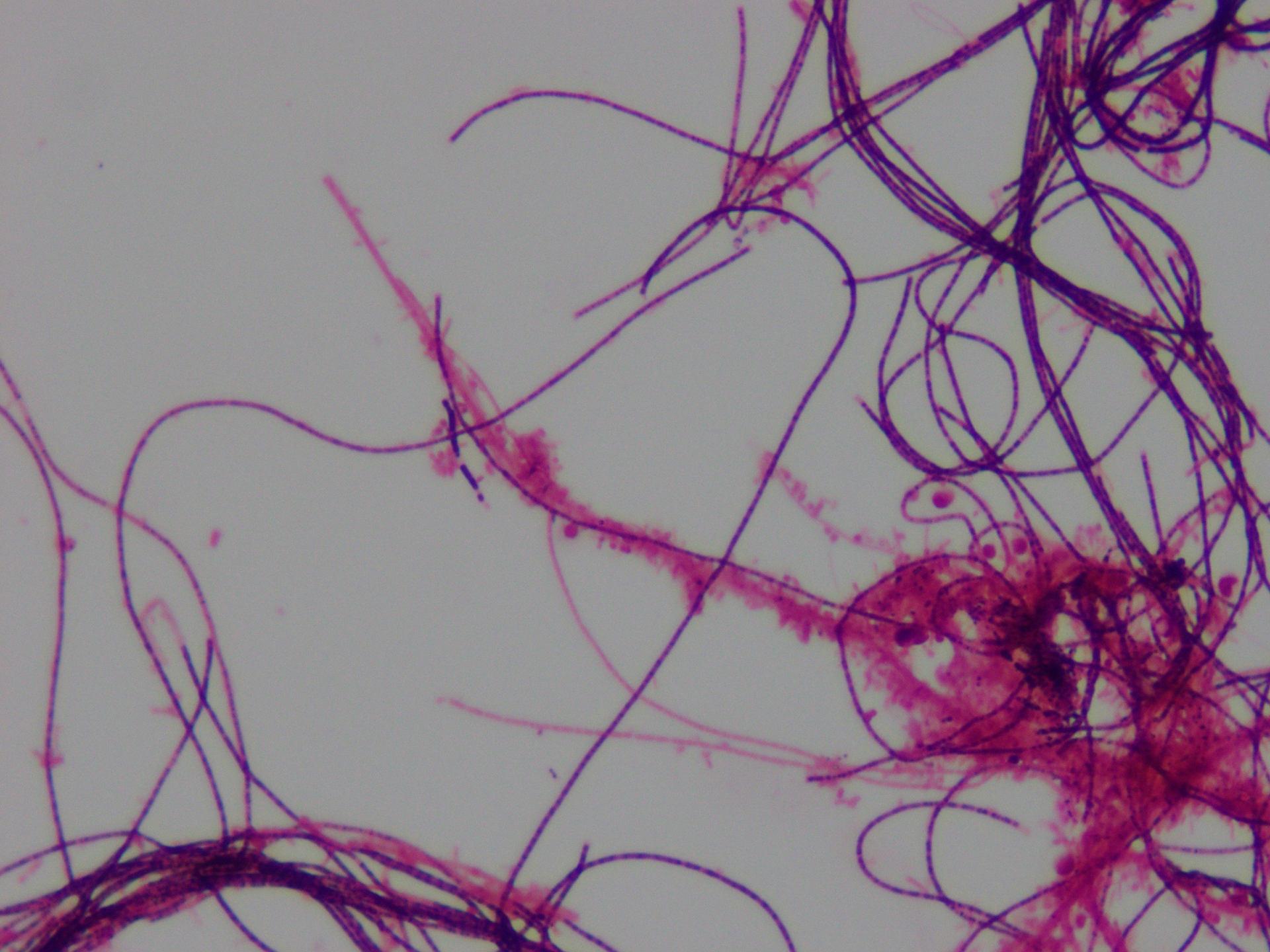 microscopic image of filamentous bacteria